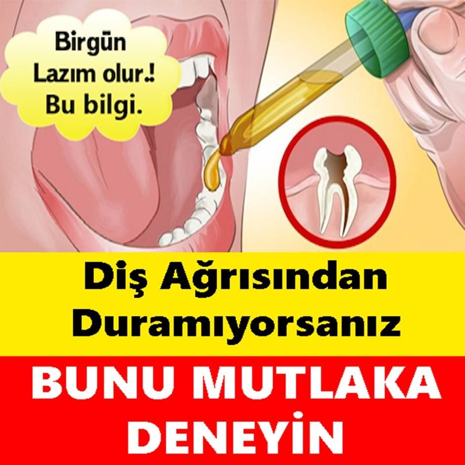 Diş Ağrısından Duramıyorsanız Bunu Mutlaka Deneyin