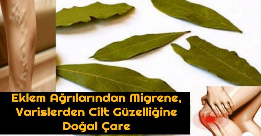Eklem Ağrılarından Migrene Varislerden Cilt Güzelliğine Doğal Çare