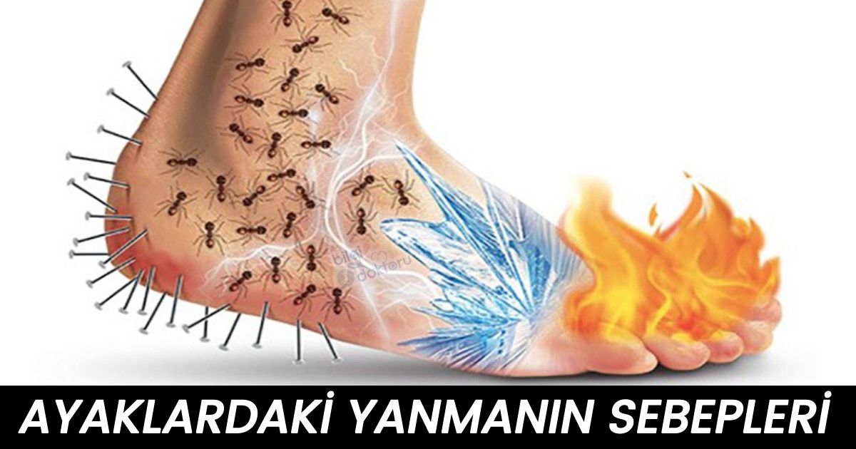 Ayaklarda Yanmanın Sebebi