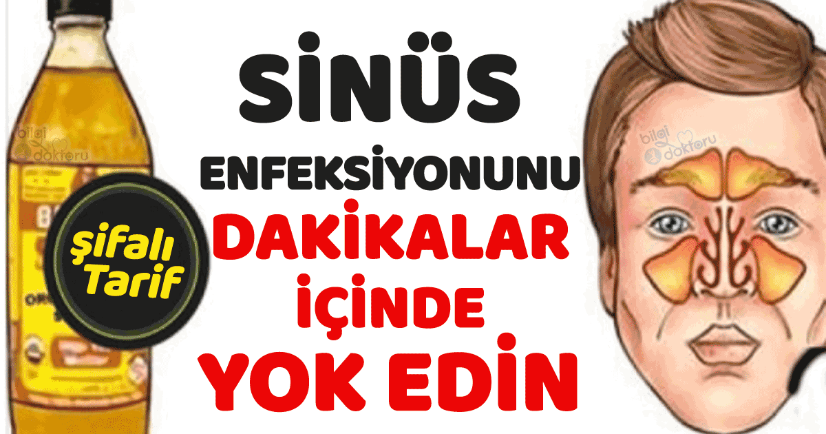 Bu Karışımla Migren-Sinüs Enfeksiyonunu Dakikalar İçinde Yok Oluyor