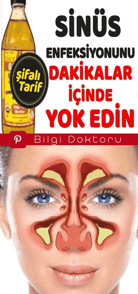 Bu Karışımla Migren-Sinüs Enfeksiyonunu Dakikalar İçinde Yok Oluyor
