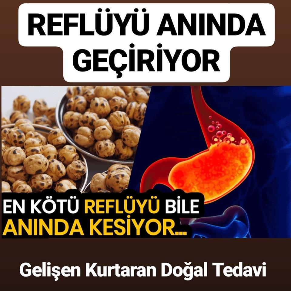 En Kötü Reflüyü Bile Geçiren Doğal Tedavi