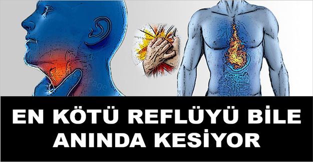 En Kötü Reflüyü Bile Geçiren Doğal Tedavi