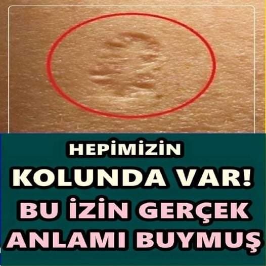 Hepimizin Kolunda Var