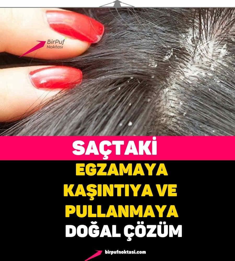 Saçtaki Egzamayı Geçiren Kür