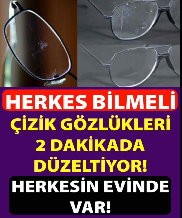 Çizik Gözlükleri İki Dakikada Düzeltiyormuş