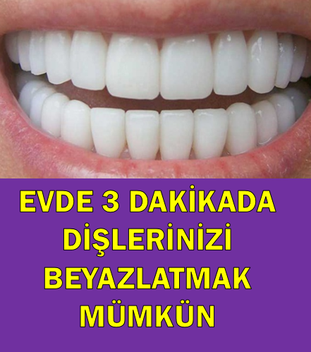 Evde 3 Dakikada Dişlerinizi Beyazlatmak Mümkün