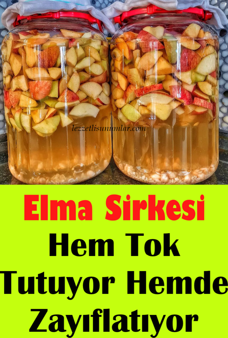 Elma Sirkesi İle Zayıflama