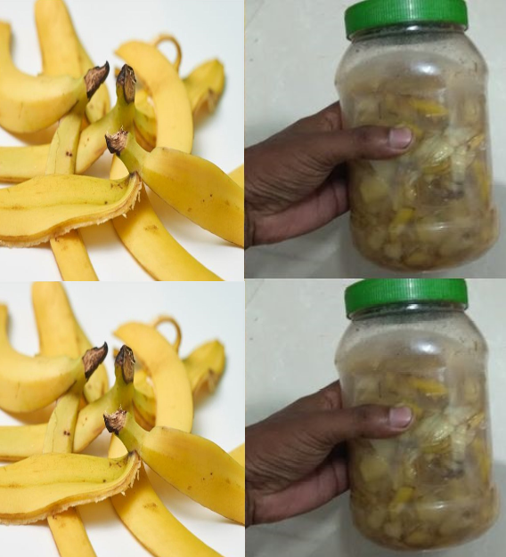 Muz Kabuğunu Ç-öpe Atmayın